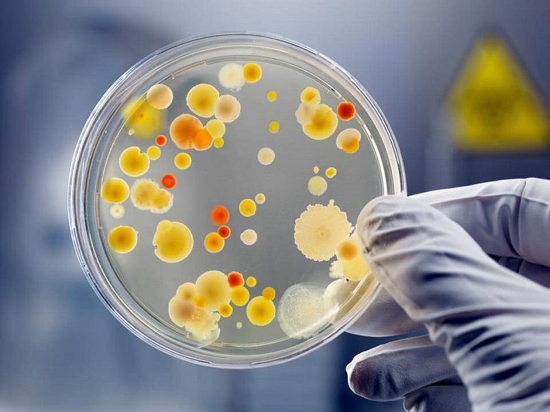 microbiological-tests Xét nghiệm vi sinh để làm gì? Bao gồm những loại xét nghiệm nào?